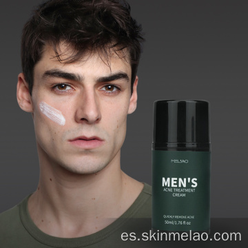 Crema de tratamiento de acné de hombre hidratante anti -envejecimiento